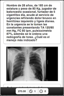 How to mod Simulador MIR patch 1.0.77 apk for android