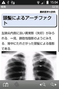 最新医学大辞典（「デ辞蔵」用追加辞書）