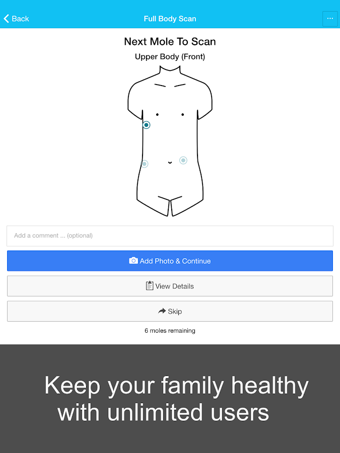    Skin Cancer App - MySkinPal- screenshot  