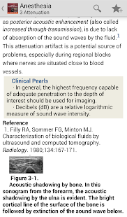 Atlas Ultrasound Anesthesia TR Screenshots 2