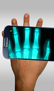 Xray Scanner Prank - screenshot thumbnail