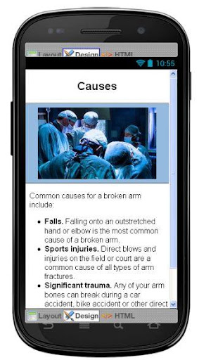【免費醫療App】Broken Arm Disease & Symptoms-APP點子