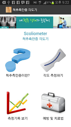 척추측만증 각도기