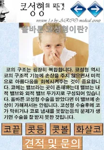 코성형의 모든것