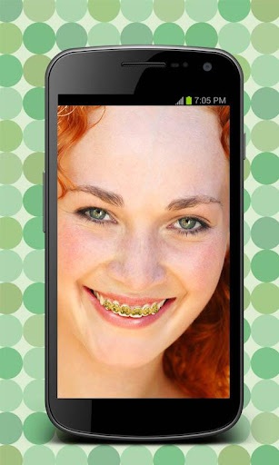 【免費攝影App】Fake Braces : Face Changer-APP點子