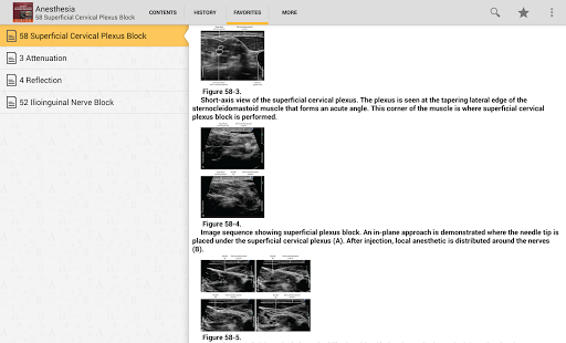 Atlas Ultrasound Anesthesia TR Screenshots 9