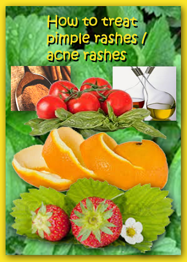 Pimple Acne Rashes Treatment