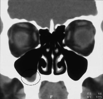 Xray_1