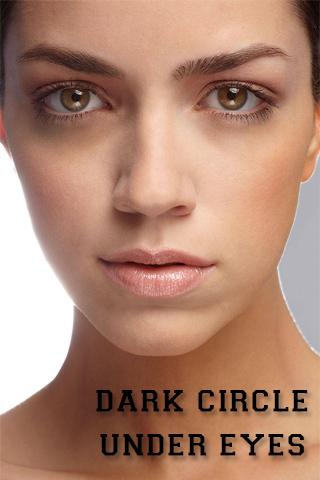 Dark Circle Under Eyes