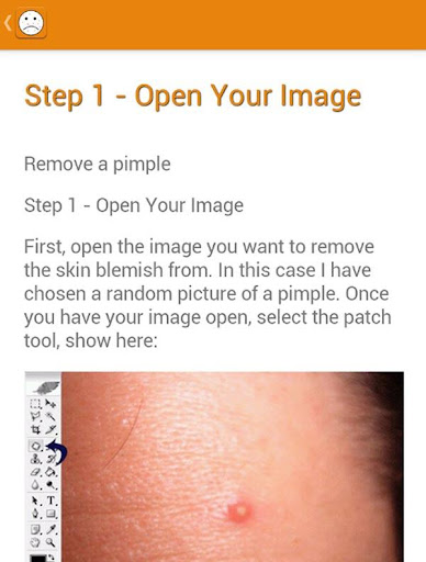 Remove Pimples in Photos Tip