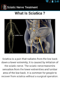How to download Sciatic Nerve Treatment patch 1.0 apk for pc