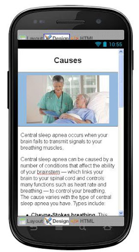 【免費醫療App】Central Sleep Apnea Disease-APP點子