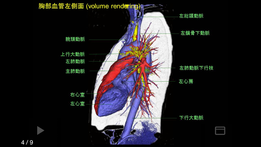 e画像解剖