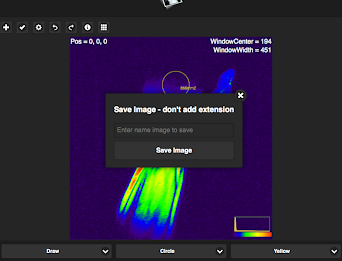 Simple Dicom Viewer poster 8