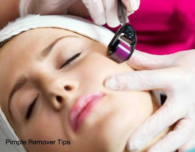 How to get Pimple Remover Tips 1.7 mod apk for laptop