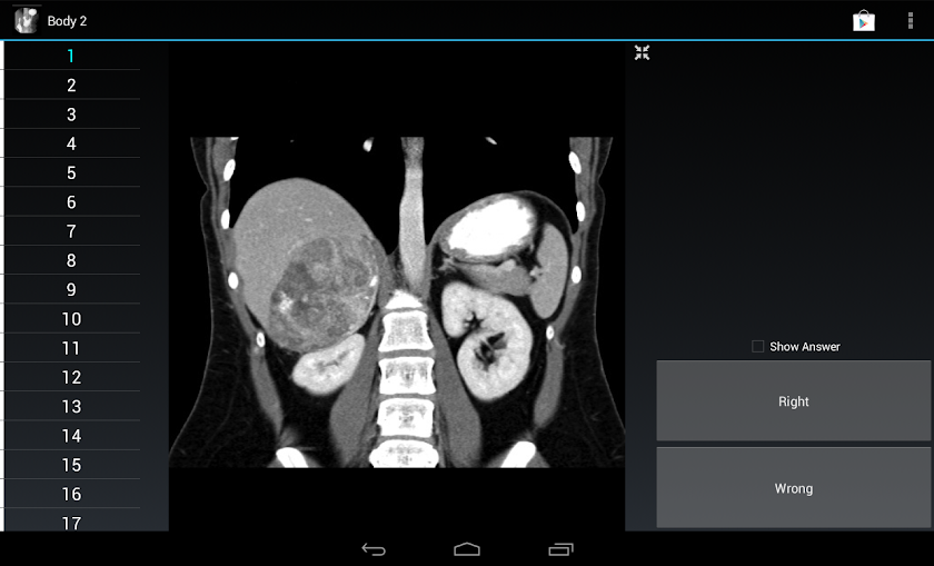 Radiology Flashcards: Body 2 Screen 3