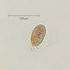 Ciliated Protozoan