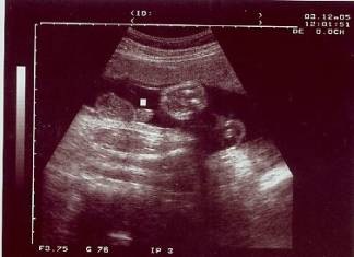 [clip_image002[3].jpg]