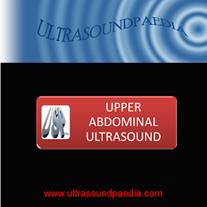 Upper Abdominal Ultrasound