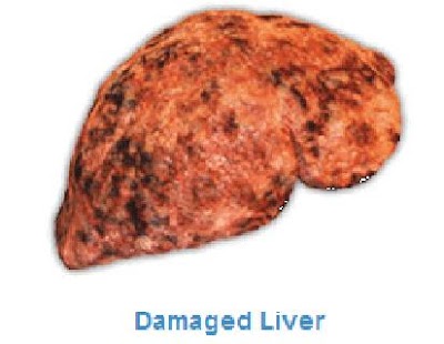 Free Download Liver Disease Info APK for Android