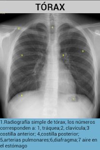 How to mod Radiografías patch 1.0 apk for bluestacks