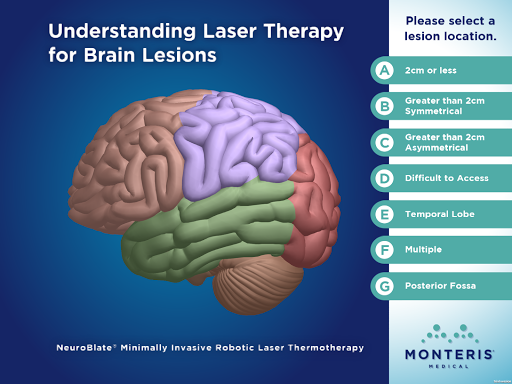 Laser Therapy - Tablet Version