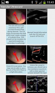 How to get Vascular Ultrasound 1.0 mod apk for pc