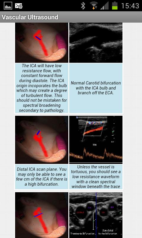 Vascular Ultrasound Screen 2