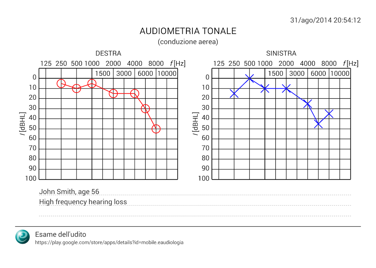   Esame dell'udito- screenshot 