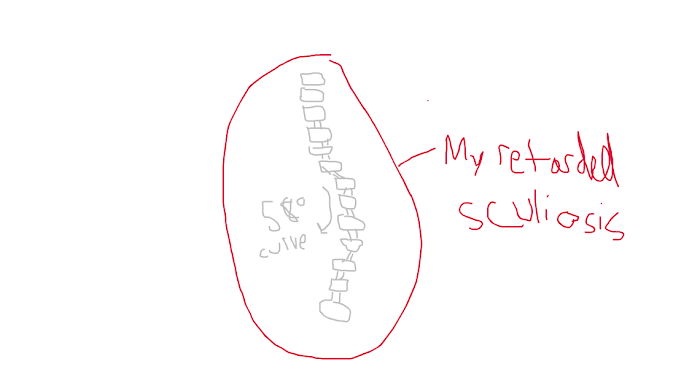 A retarded drawing of my retarded spine