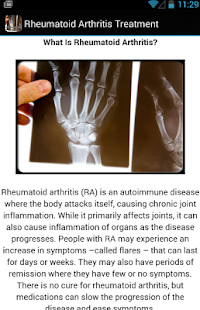 Rheumatoid Arthritis Treatment Screenshots 2