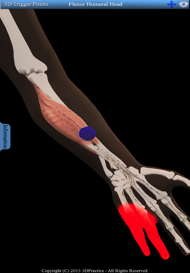 3D Trigger Points Screen 2