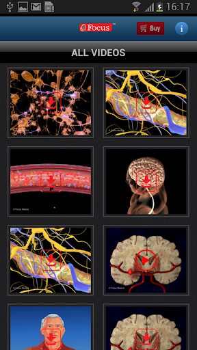 【免費醫療App】FAQs in Stroke-APP點子