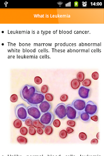 Leukemia Screenshots 1