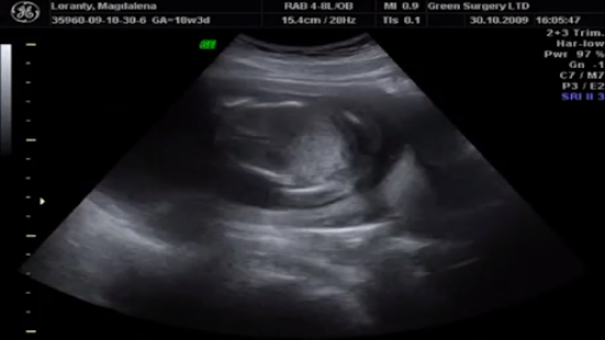 USG BABY RADAR Screenshots 1