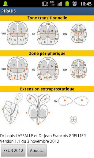 PI-RADS IRM Prostate fr