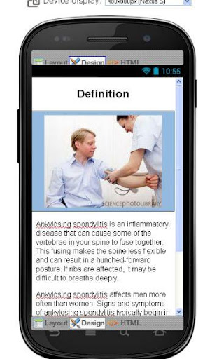 【免費醫療App】Ankylosing Spondylitis Disease-APP點子