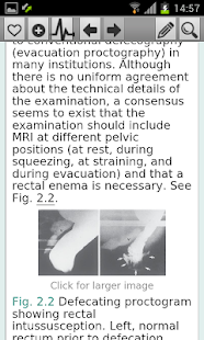 Free Oxford Handbook Gastroentero2 APK