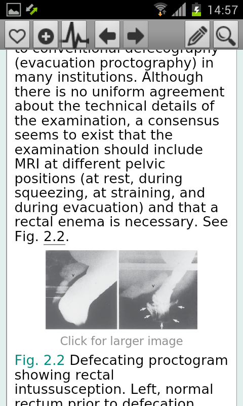 Oxford Handbook Gastroentero2 Screen 3