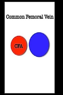 iSonographer Venous R/O DVT