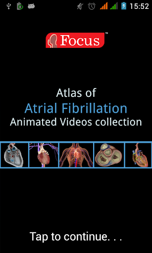 Atlas of Atrial Fibrillation