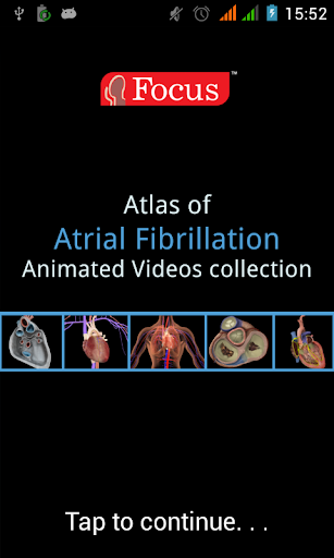 【免費醫療App】Atlas of Atrial Fibrillation-APP點子