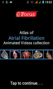 How to install Atlas of Atrial Fibrillation 1.0 unlimited apk for android